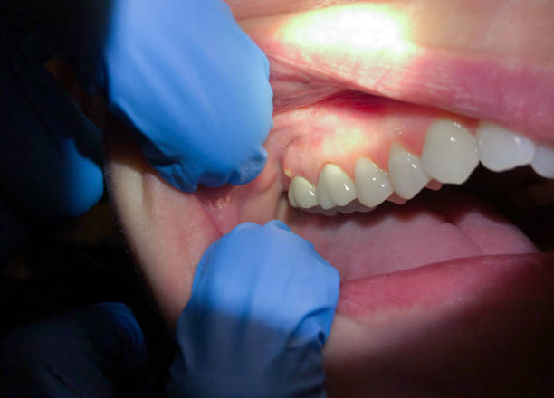 Best After-Hours Dental Trauma Care in Lewisburg, KY