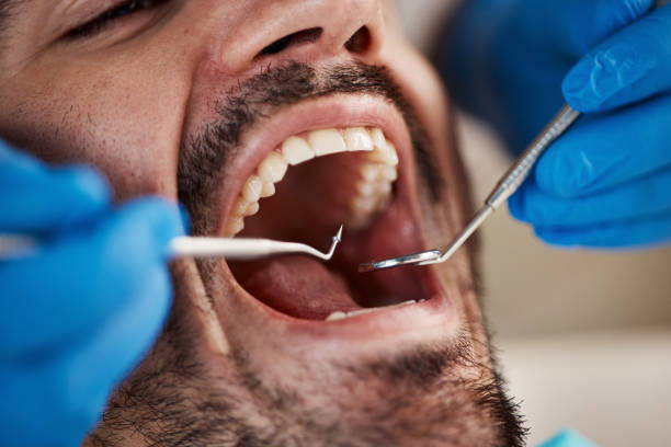 Best Emergency Root Canal Treatment in Lewisburg, KY