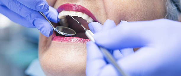 Best Emergency Tooth Extraction in Lewisburg, KY